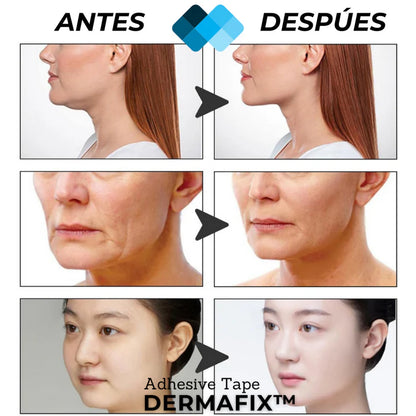 Parches de Lifting Facial Adhesivos Invisibles Liftrik InnovaGoods 40 unidades